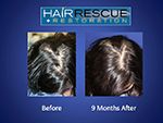 Hair Rescue - Female
