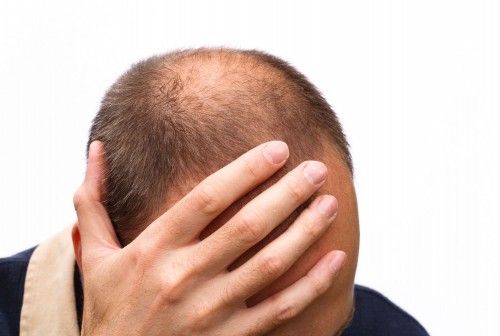 Man with thinning hair with hand on head