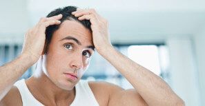 male model for hair loss Nyhairloss