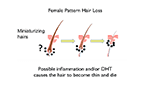 female pattern hairloss mechanism